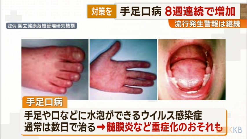 KKB NEWS