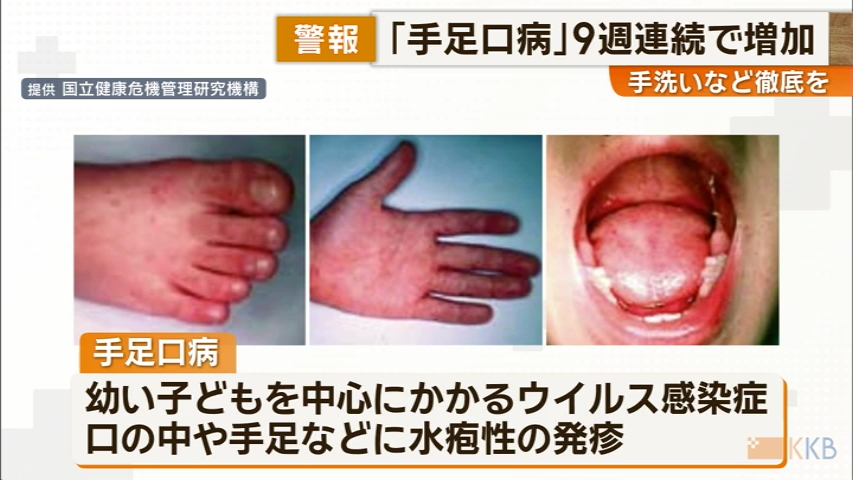 KKB NEWS